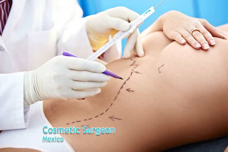 Top 4 plastic surgeons in Mexico
