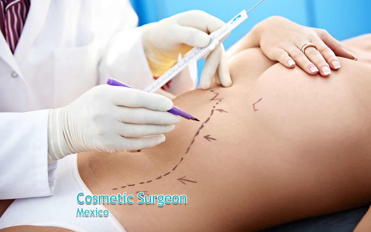 Top 4 plastic surgeons in Mexico
